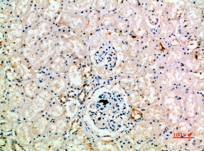 CD218b Polyclonal Antibody