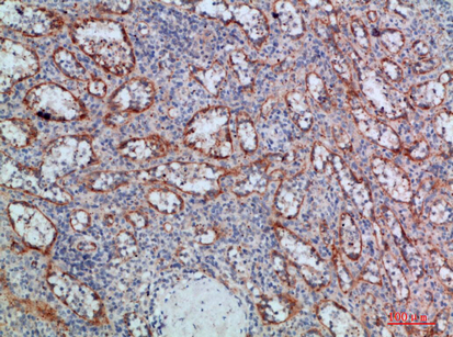 LT-β Polyclonal Antibody