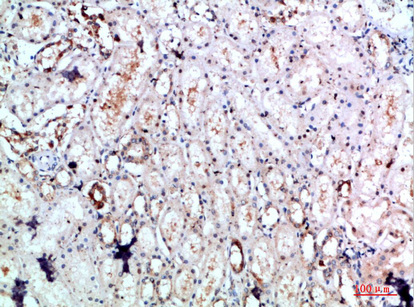DLEU7 Polyclonal Antibody