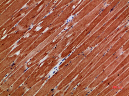 TTN Polyclonal Antibody