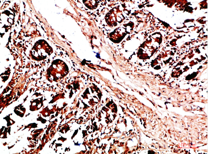 HLA-DQA1 Polyclonal Antibody
