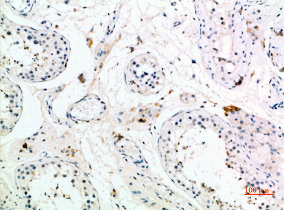 PMCH Polyclonal Antibody