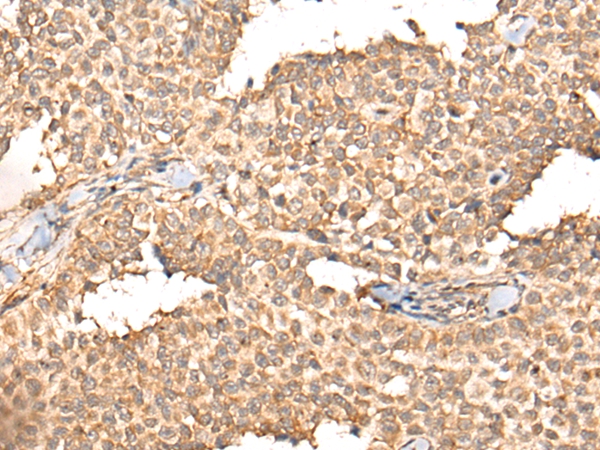 APOBEC1 Antibody
