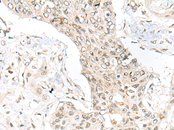 ASXL1 Antibody
