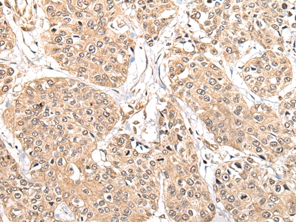 ATL3 Antibody
