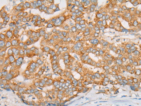 ATXN7 Antibody