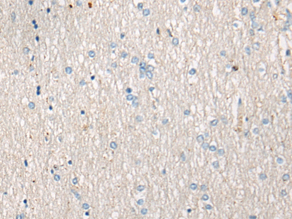 AVPR1B Antibody