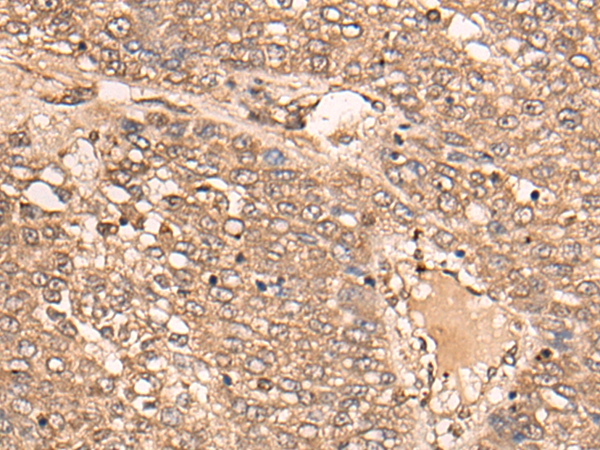 B4GALNT2 Antibody