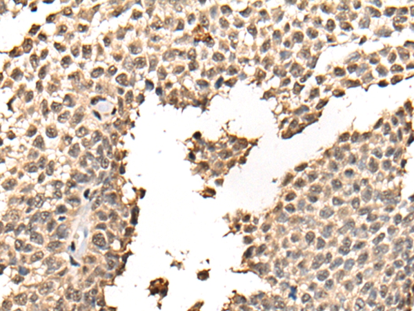 BATF Antibody