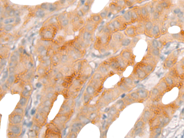 BBOX1 Antibody