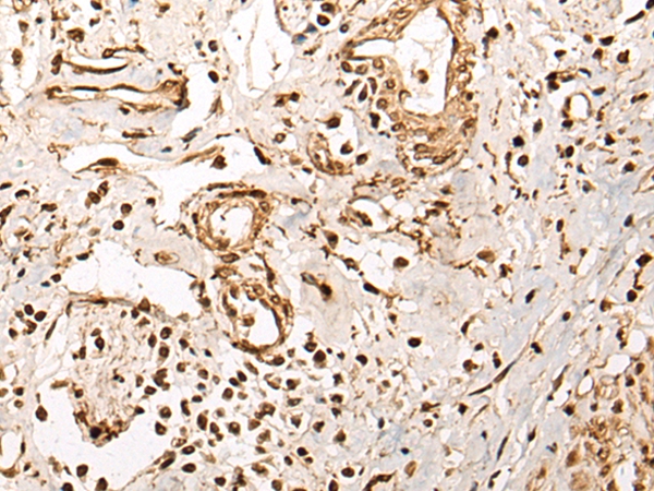 BCL9 Antibody