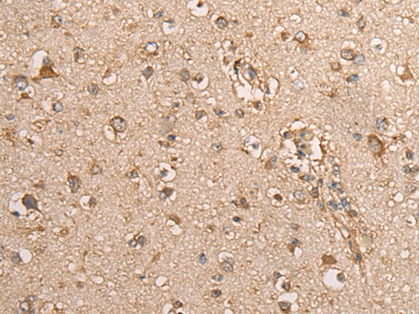BEX1 Antibody