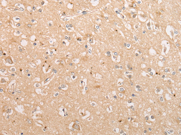 C15orf40 Antibody