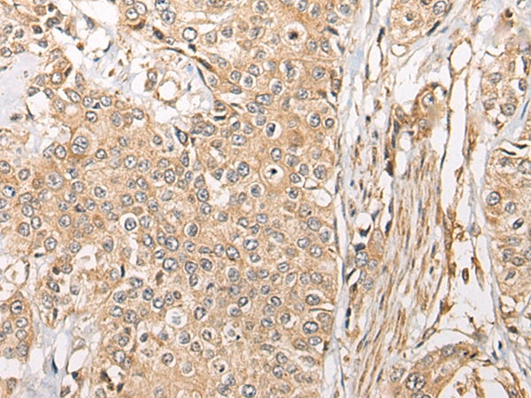 C2CD2 Antibody