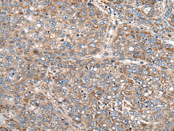 CADM2 Antibody