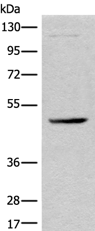 CAMKK1 Antibody