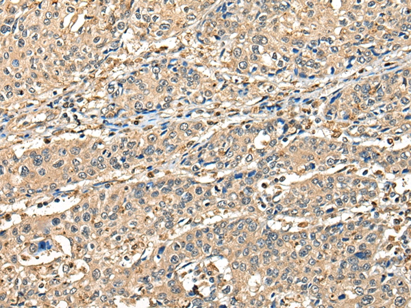 CCDC112 Antibody