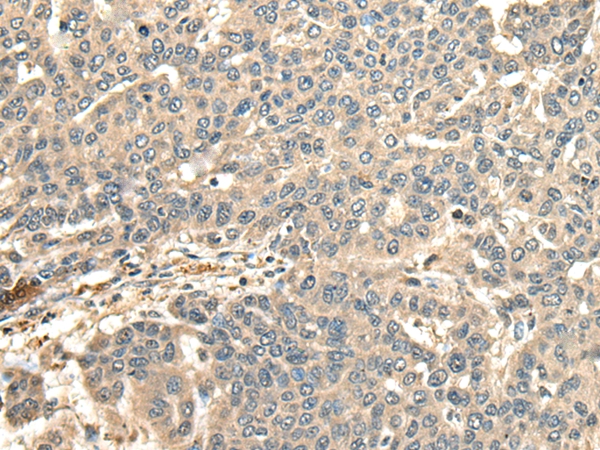 CCDC113 Antibody