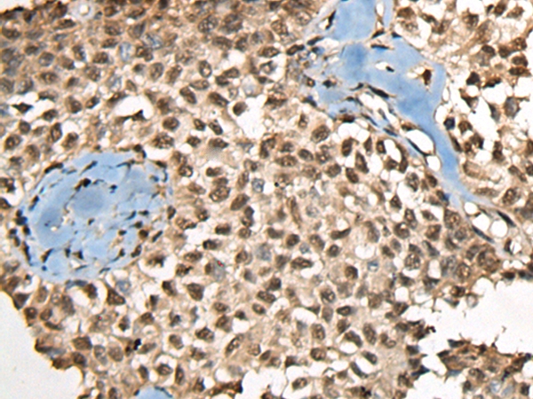 CCDC12 Antibody