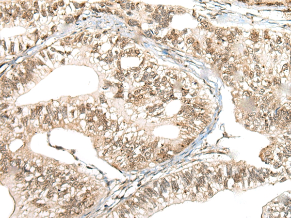 CCNK Antibody
