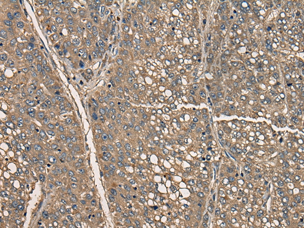 CD5 Antibody