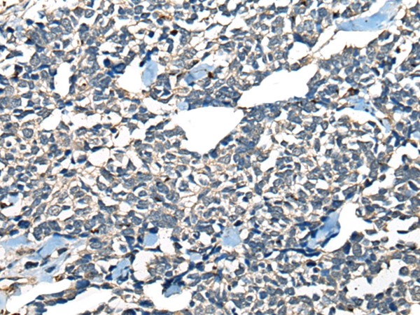 CDADC1 Antibody