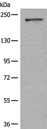 CDC42BPA Antibody