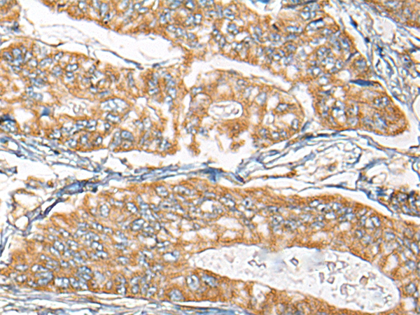 CDC42EP2 Antibody