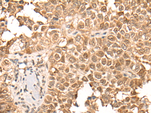 CDCA5 Antibody