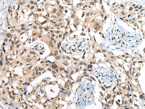 CDKL2 Antibody