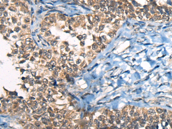 CDKL4 Antibody