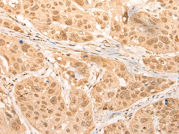 CDKN2AIPNL Antibody