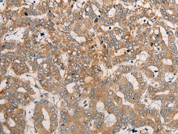 CEND1 Antibody