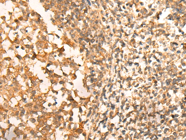 CEP57 Antibody