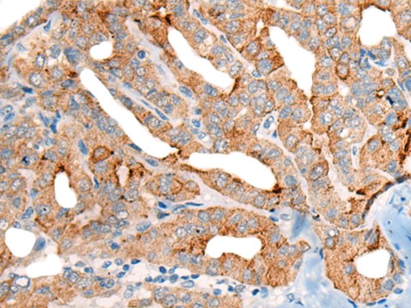 CETN3 Antibody