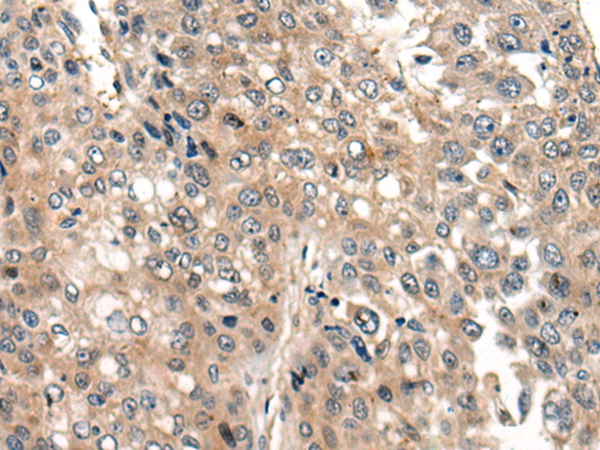 CFL2 Antibody