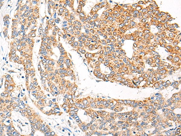 CHMP5 Antibody
