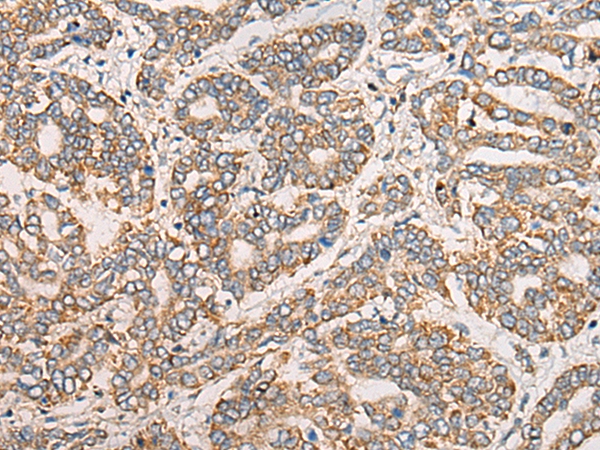 CLASP2 Antibody
