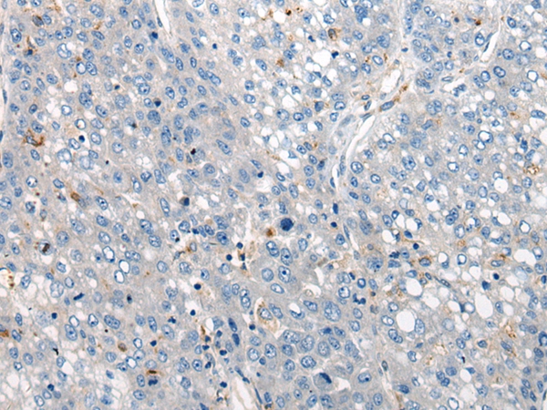 CLCNKA Antibody