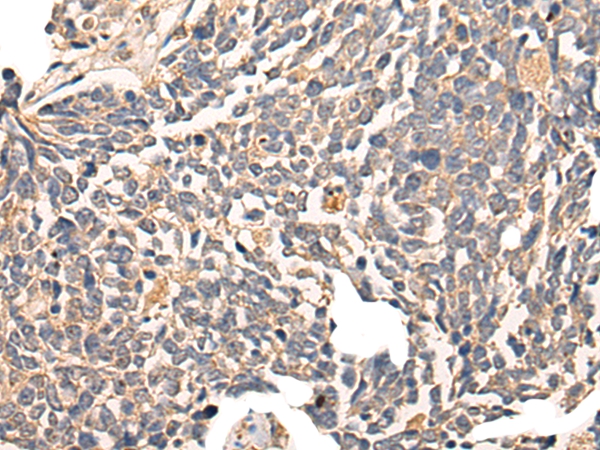 CLINT1 Antibody