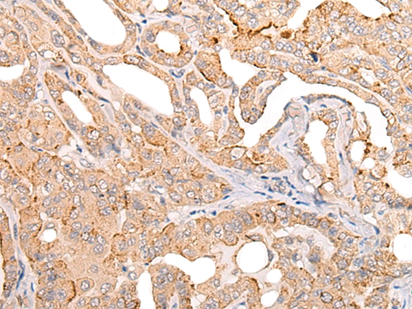 COL11A1 Antibody