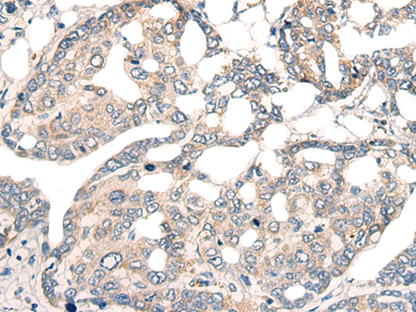 CORO2A Antibody
