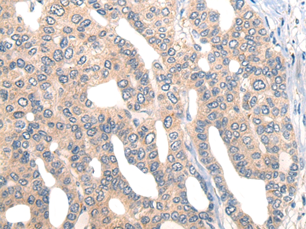 CORO2B Antibody