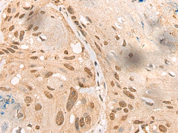 FAM175A Antibody