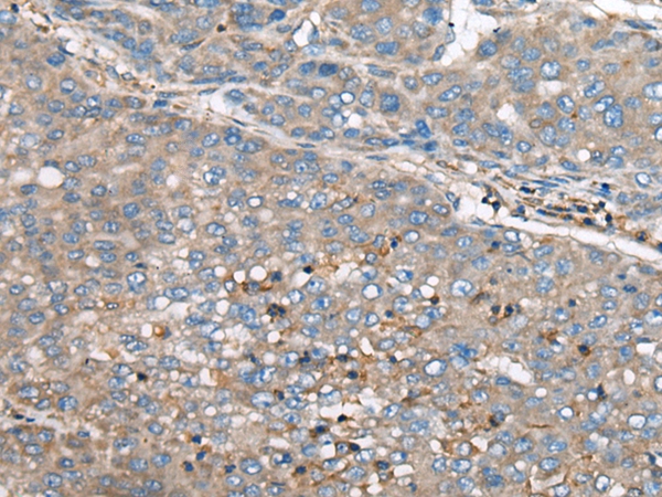 GULP1 Antibody