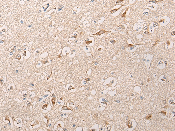 HTRA1  Antibody