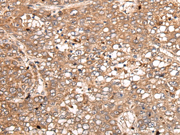 IGFBP2 Antibody