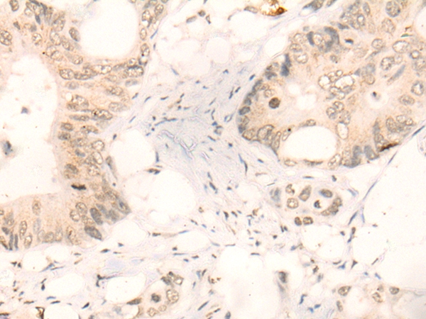 KLF2 Antibody