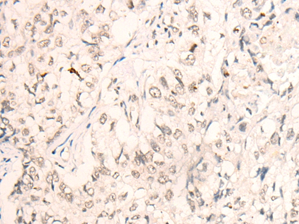 KLF2 Antibody