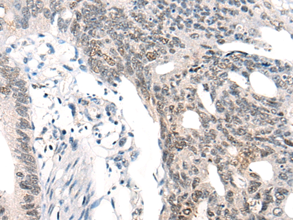 MBD2-b Antibody